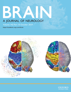 M_brain_142_10cover